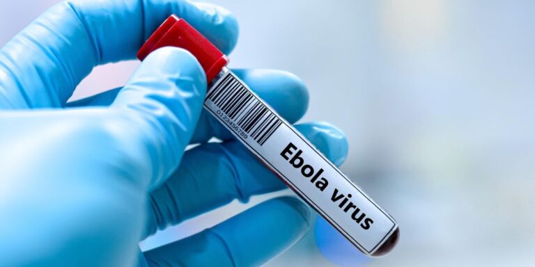 Ebola vijon të përhapet në Kongo, gati 3 mijë viktima